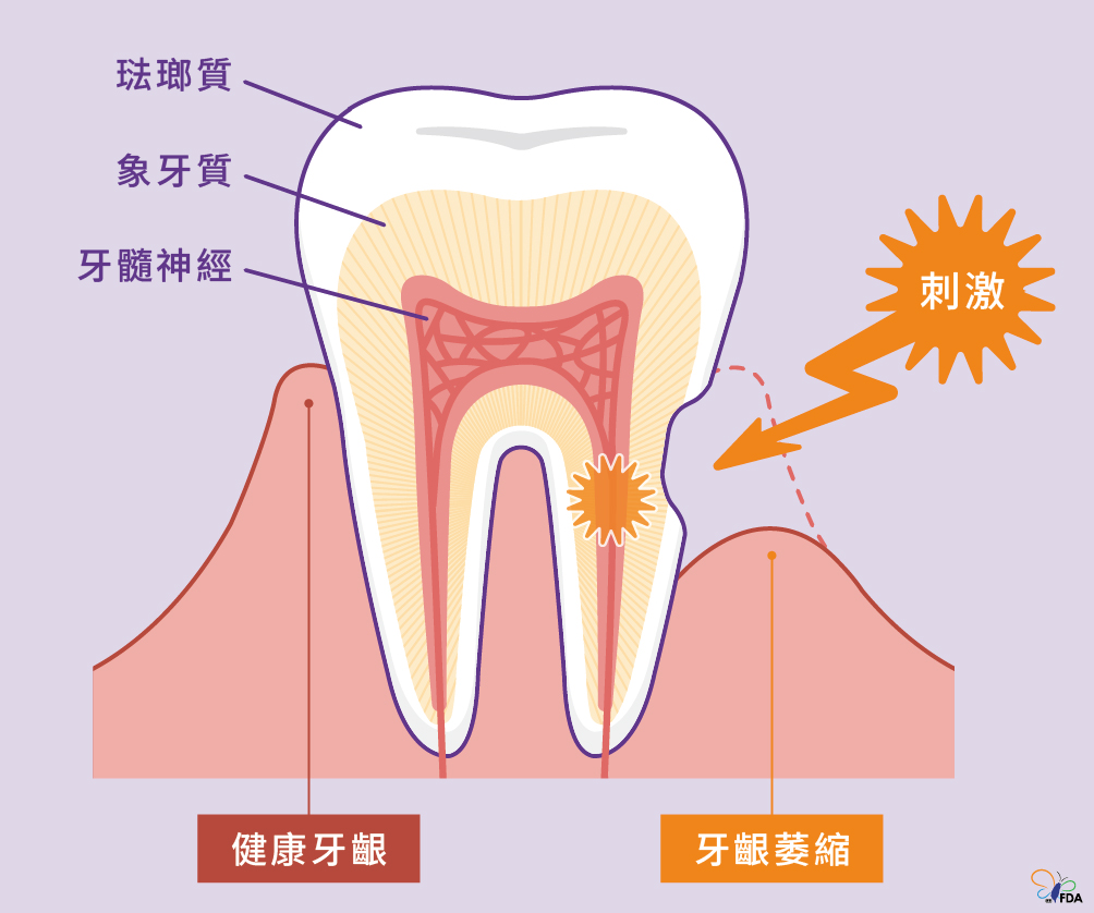 抗敏感牙膏作用機制主要分為兩類