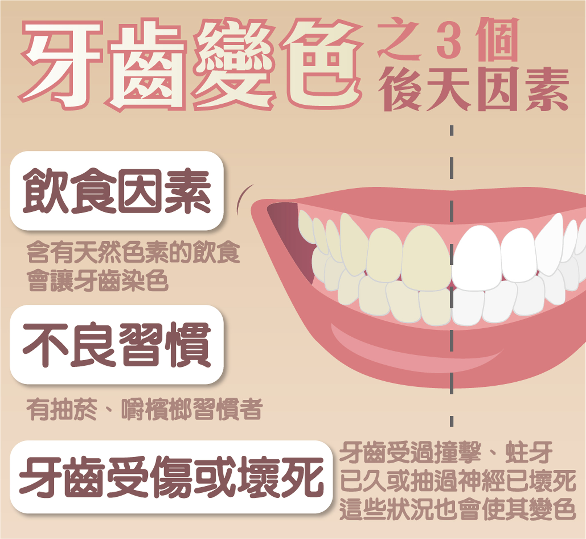 飲食、不良習慣、牙齒受傷為牙齒變色的三個後天因素。