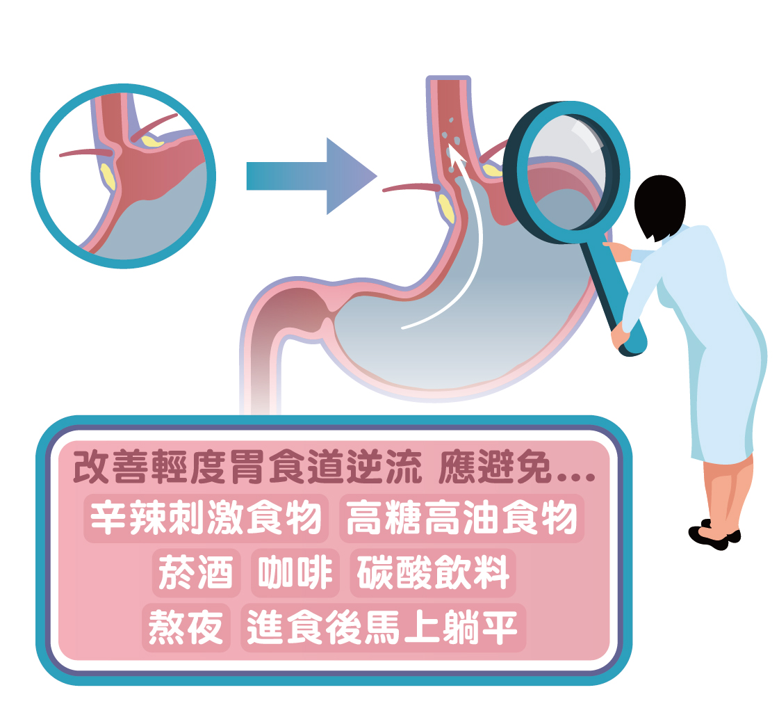 改善輕度胃食道逆流