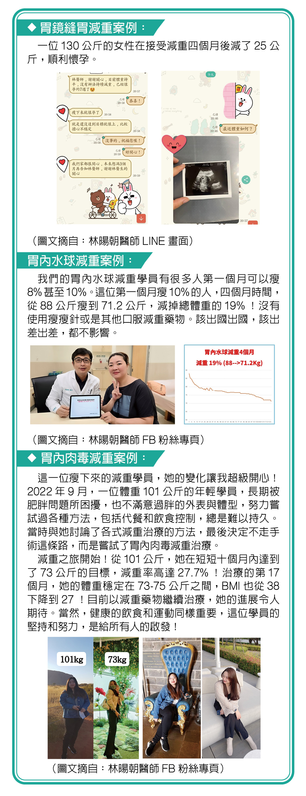 胃鏡減重臨床實例